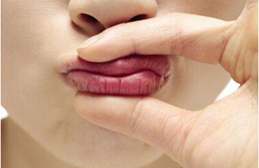 Ƽ|blistexС׹ܣרҵںףٸɵĿںҲ